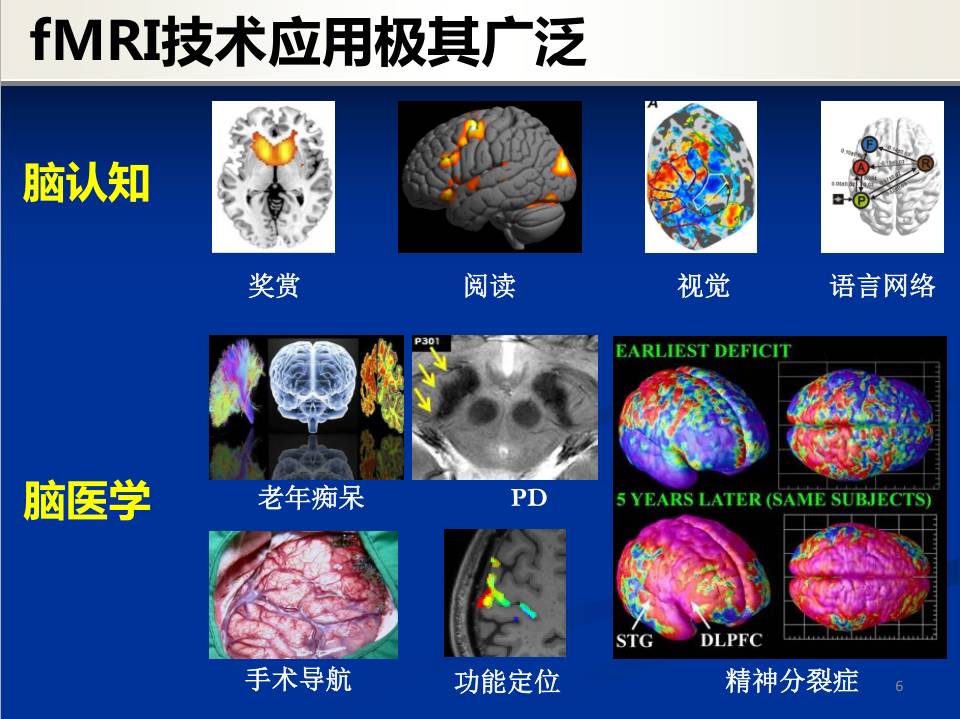 磁共振成像在医学诊断中的应用_磁共振成像在医学诊断中的应用研究